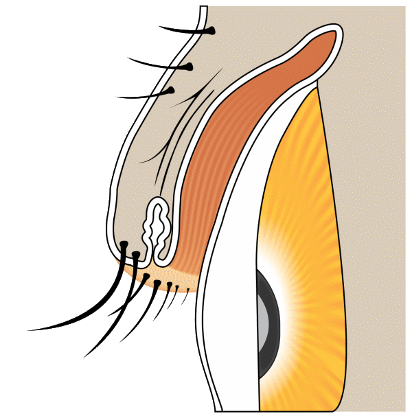 Normal eyelash morphology diagram